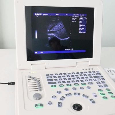 calidad GYN Factory Supply Dw580 Portable Ultrasound Machine For Sale fábrica